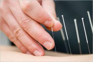 Acupuncture et médecine chinoise à Valence